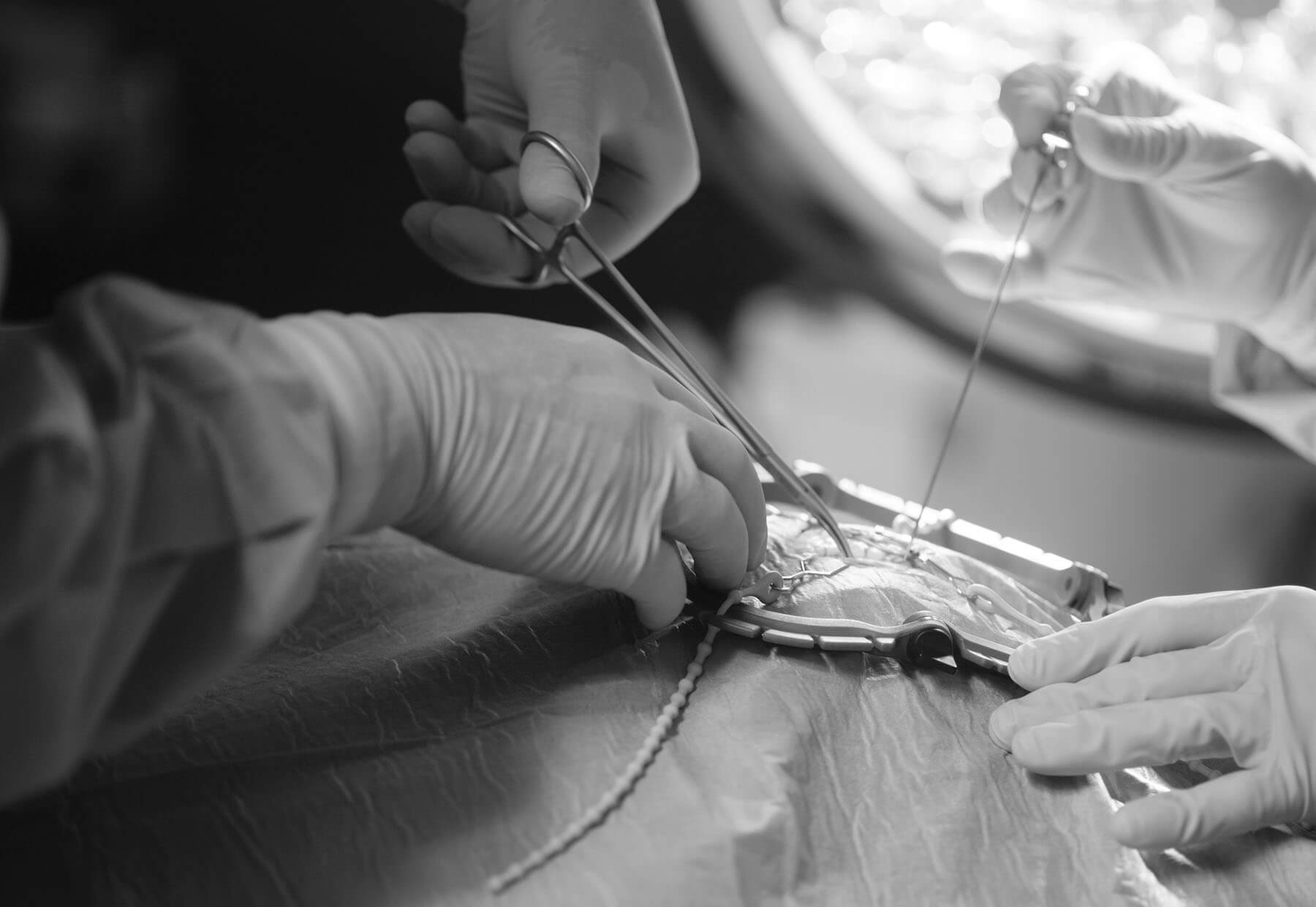 OP-Szene mit evoFrame Retraktionssystem im Einsatz und zwei Operateuren mit Chirurgischen Instrumenten